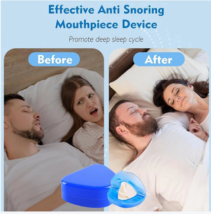 Anti Snore Mouth-Piece